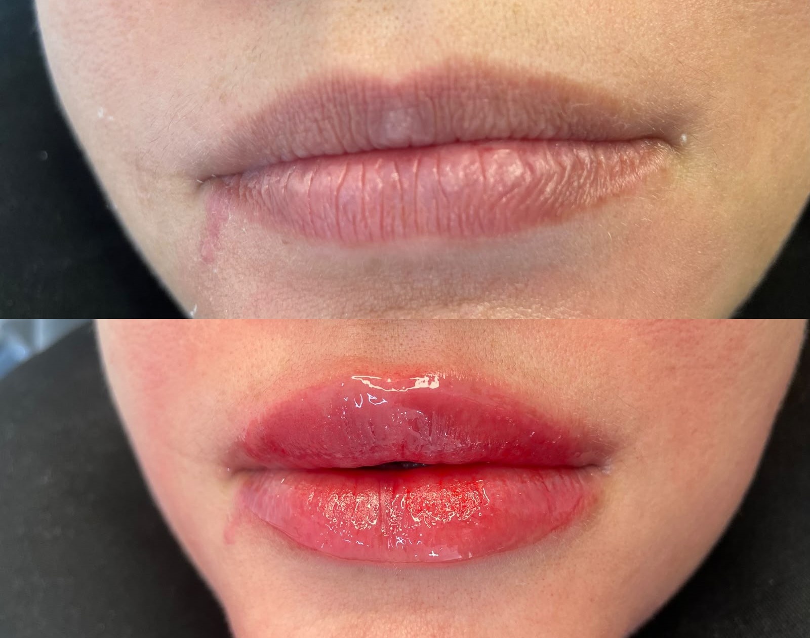 Antes e depois de hidragloss 1