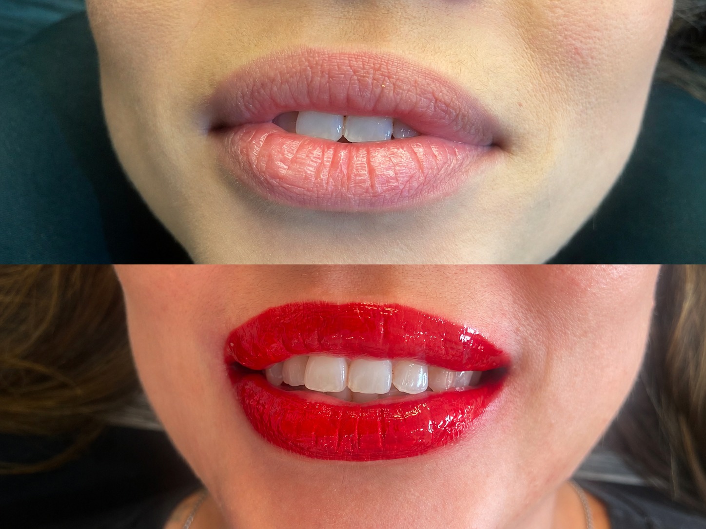Antes e depois de hidragloss 3