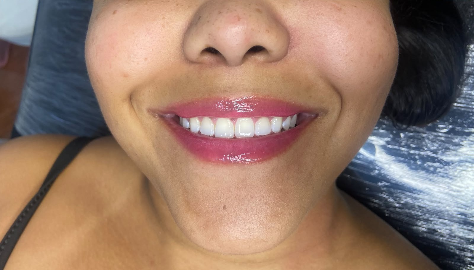 Resultado de hidragloss